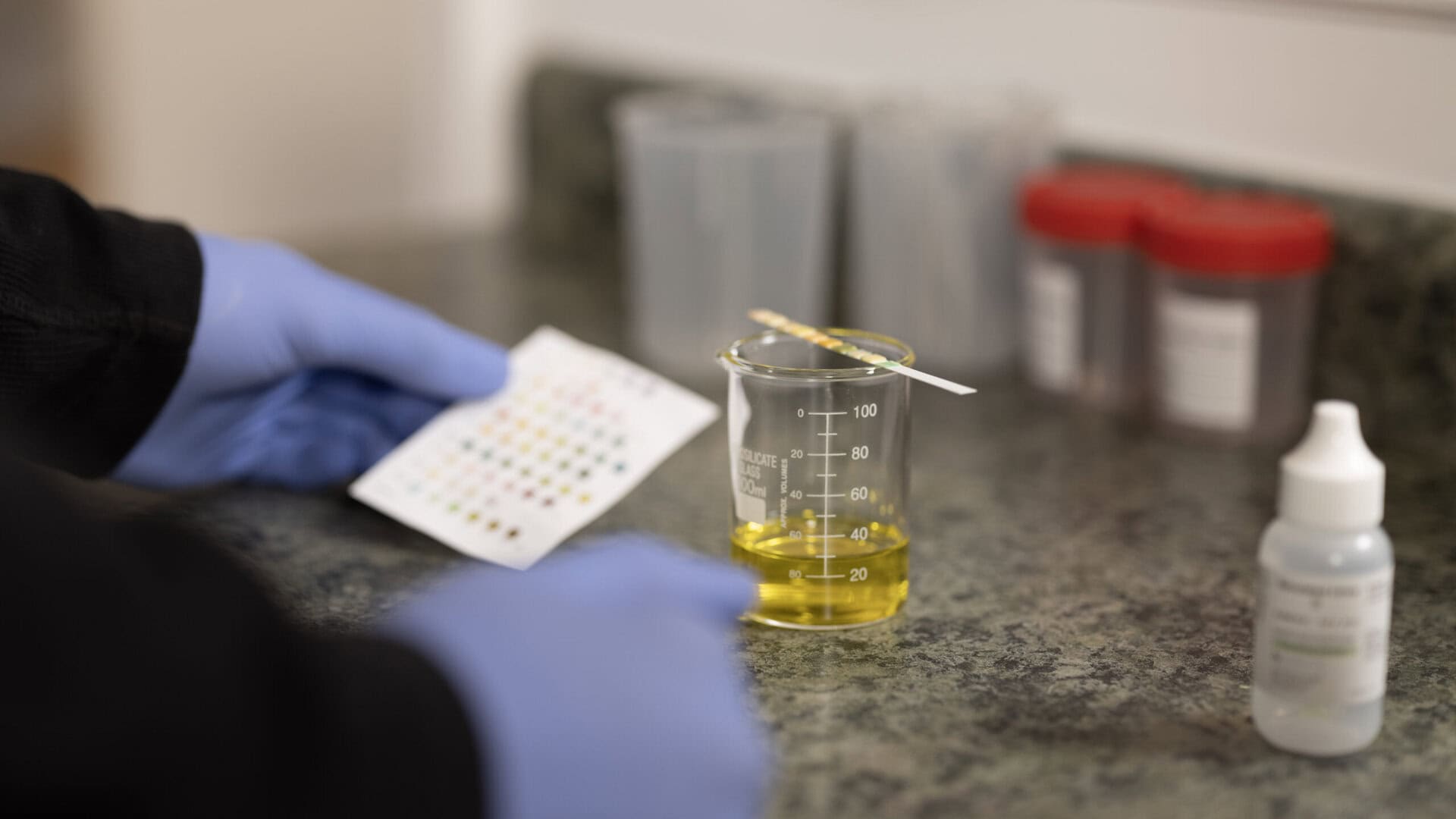 Urinalysis Lab Preview Featured Image